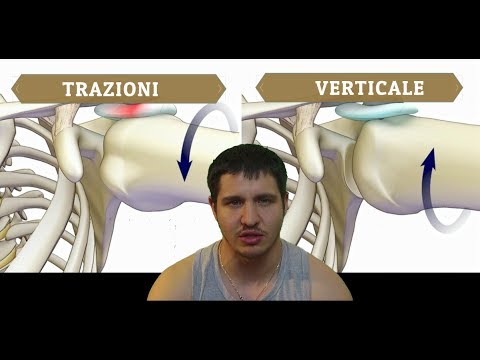 Movimento della tavola delle articolazioni e lasse di rotazione Grave dolore rastrellamento schiena