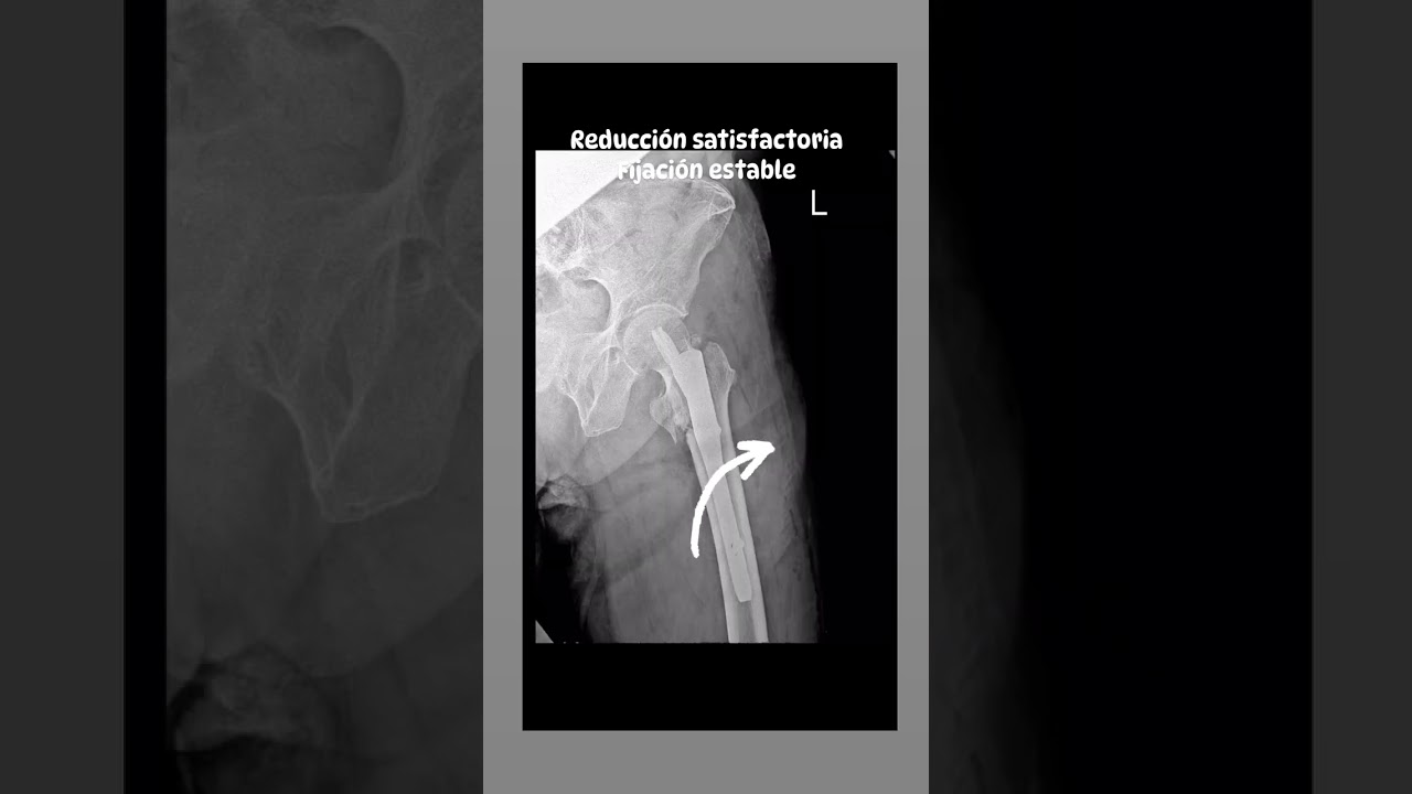 Helberth Augusto González Rico-2