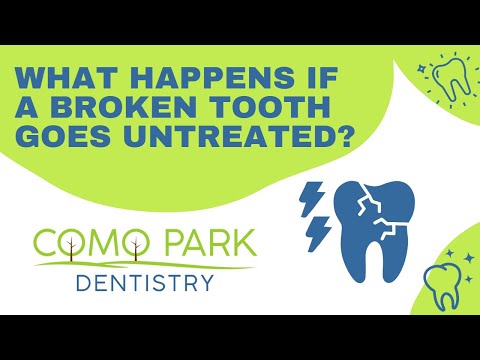 Como Park Dentistry -  What happens if a broken tooth goes untreated?