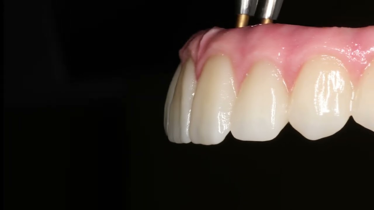 Guillermo Moreno Masiá-101