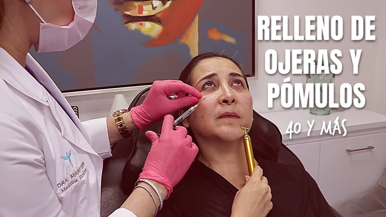 Watch Relleno de Ojeras y Pómulos con ácido hialurónico | Mujeres de 40 años y más Now Relleno de Ojeras y Pómulos con ácido hialurónico | Mujeres de 40 años y más