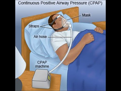 What is the C PAP Machine and how to work What is the Working Principle C PAP diff types of C PAP