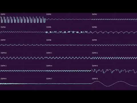 ESCHATOS - STELLAR LIGHT (ESFM Cover)