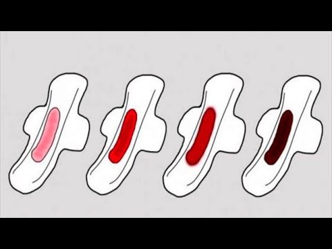 Links Bauch Gelenke Schwellung des Knöchels, und ihre Behandlung