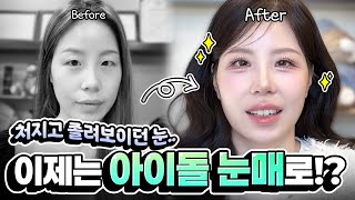 졸려보이는 눈에서 화려한 스타일로 #이미지변신 ✨윈터·고윤정 느낌까지?!ㅣ티에스성형외과