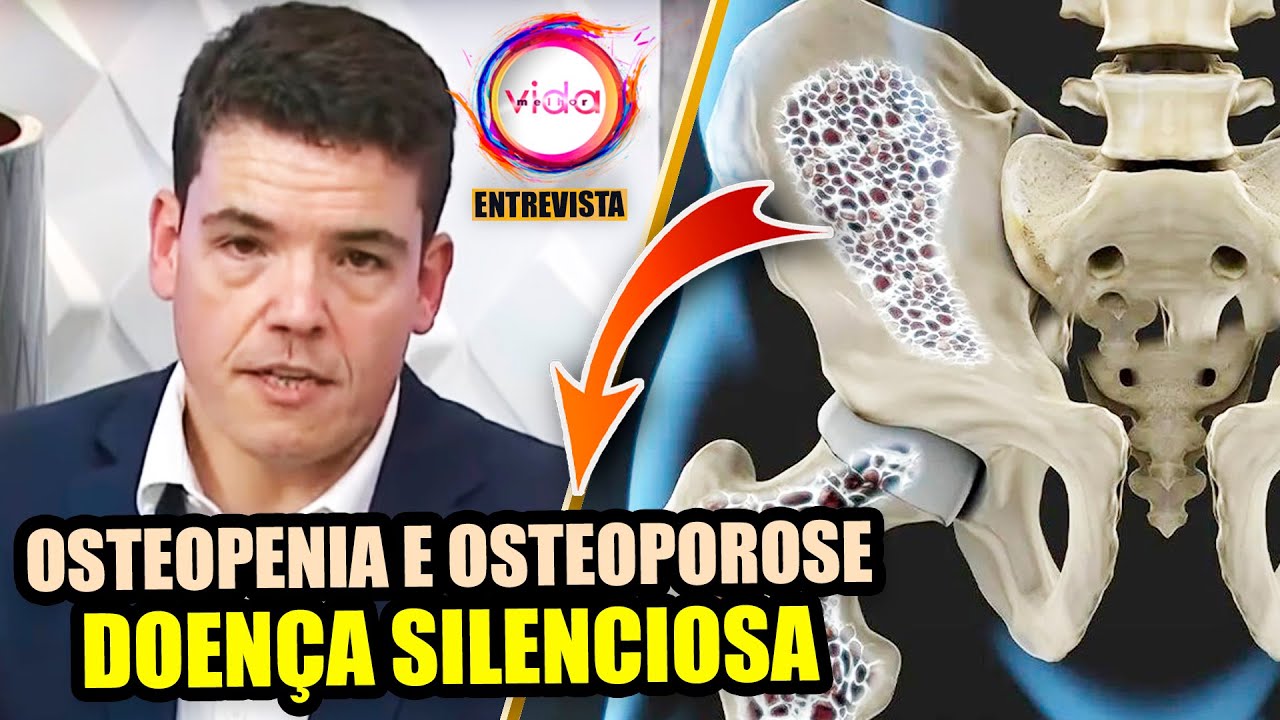 Osteopenia e Osteoporose podem causar dor articular?