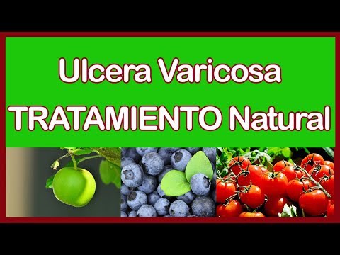 Tatuaggio con eczema Le giunture di psoriasi fanno male che fare