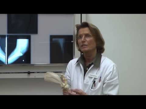 Arthroplastik des Sprunggelenks in Novosibirsk Ultraschall des Schultergelenkes Adressen Voronezh