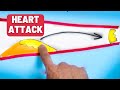 10 Rules to Prevent Heart Attack (No one thinks of the Last One)