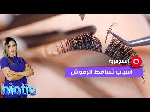 شاهد بالفيديو.. اسباب تساقط الرموش