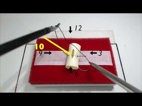 FLS (and beyond) Intracorporeal knot - Tips and Tricks