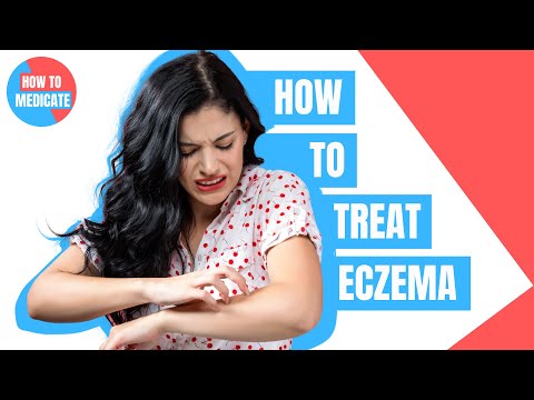 , title : 'How to treat Eczema (Dermatitis)? - Doctor Explains'