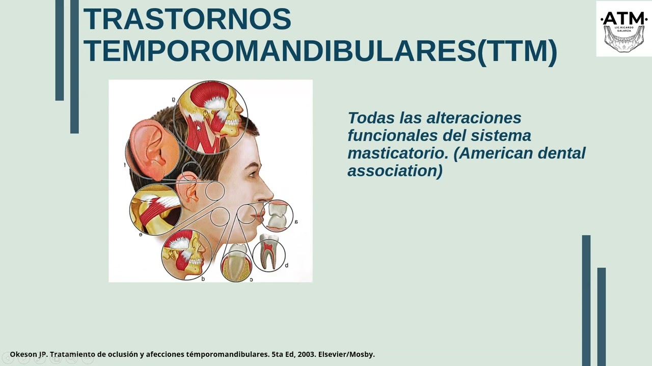 Trastornos temporomandibulares en el periodo postextubacion
