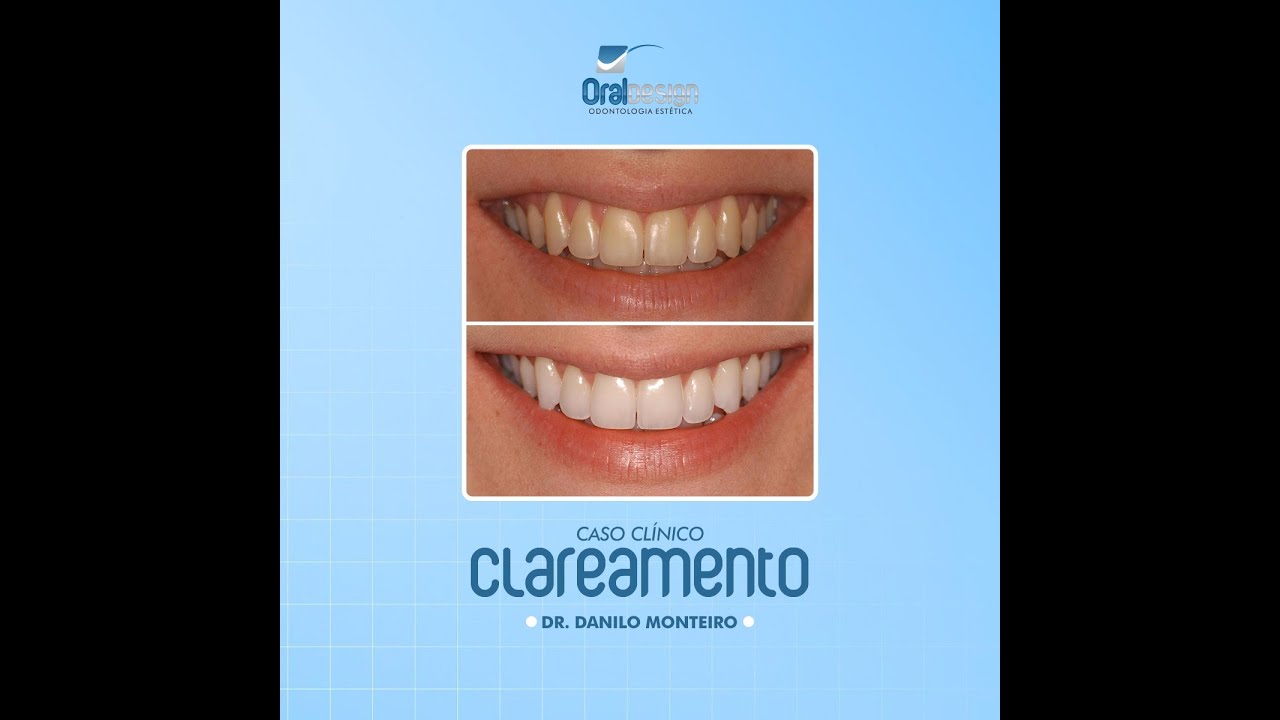 Danilo Monteiro Rezende Pereira-23