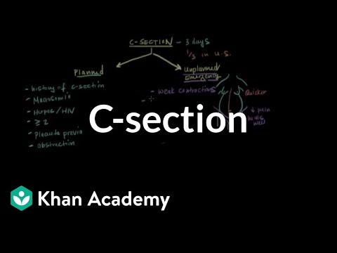 C-section | Reproductive system physiology | NCLEX-RN | Khan Academy