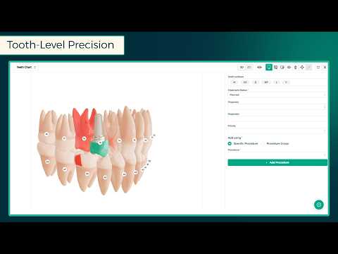 Revolutionize Your Dental Practice with Invent Medical’s 3D Charting