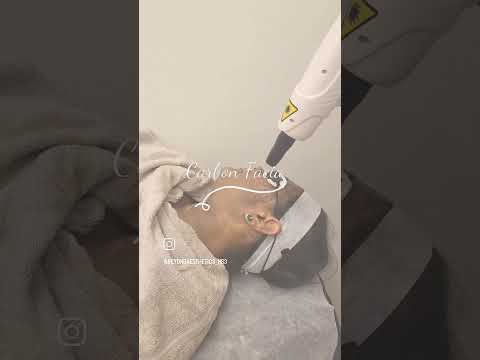 Which is your favourite treatment? | Beyond Aesthetic