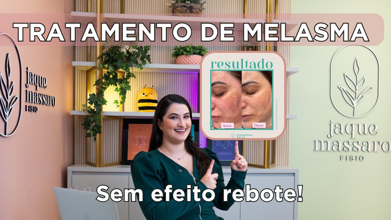 Como tratar melasma sem efeito rebote em 2024