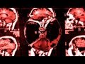 NOISE UNIT ~ Neuron