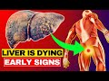 LIVER is DYING! 12 Weird Signs That You Have Liver Damage | HealthQuest