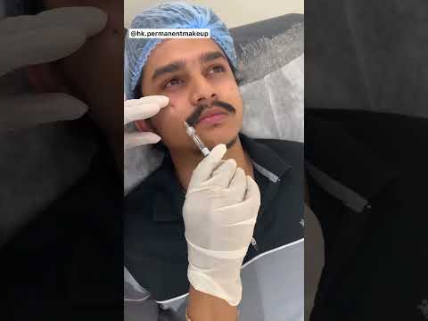 #dorasaiteja dark circle treatment at hk permanentmakeup clinic ..9052339052 Hyderabad & Vijayawada