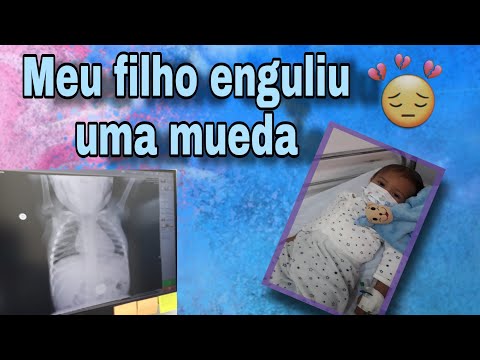 MEU Filho ENGOLIU UMA MOEDA//As crianças pegaram covid