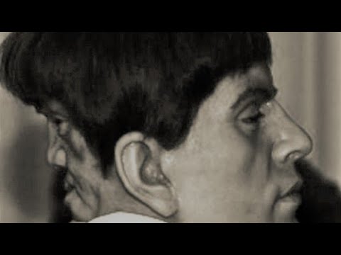 Тяжёлая жизнь со вторым лицом на затылке, которое сводило с ума