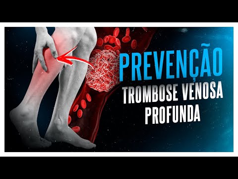 DEEP VEIN THROMBOSIS (DVT) - PREVENTION, PROPHYLAXIS