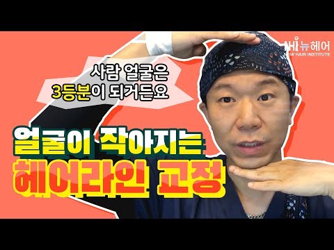 (JPN) 헤어라인 교정 얼굴이 얼마나 작아지나? - 뉴헤어 I 헤어라인