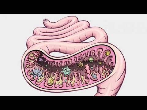 A hymenolepidosis egy tojásféreg
