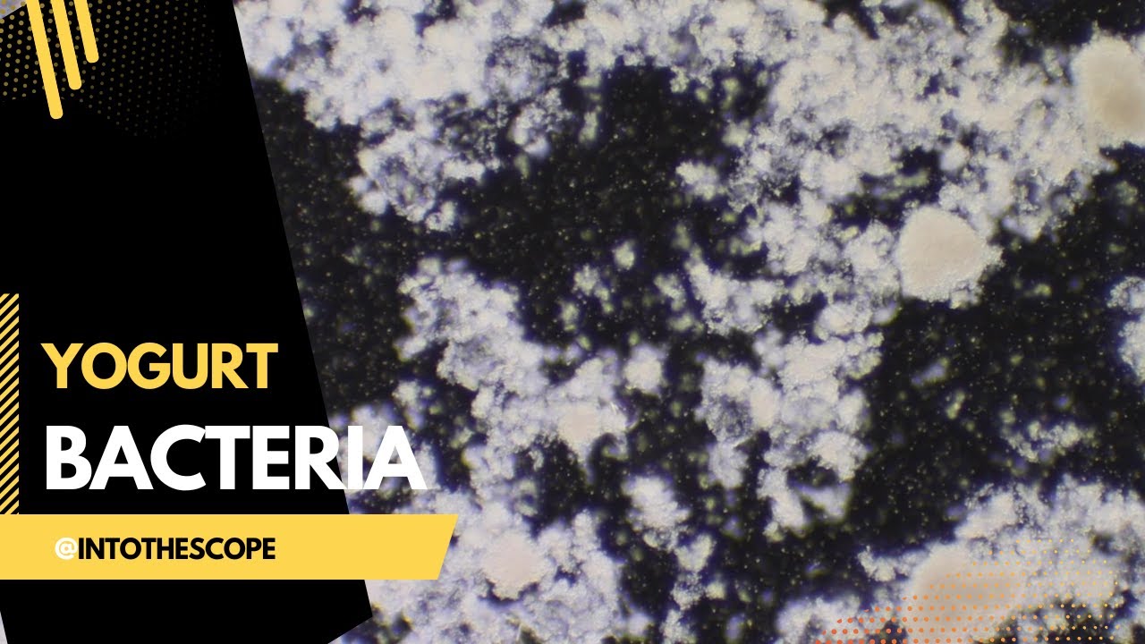 Yogurt Probiotics Under the Microscope