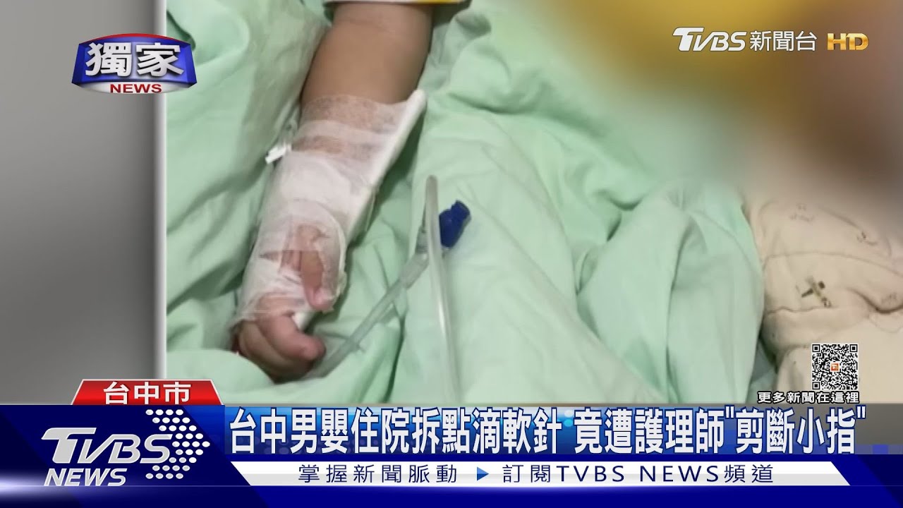 台中男嬰住院拆點滴軟針 竟遭護理師「剪斷小指」
