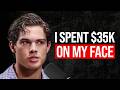 Face Determines Everything Looksmaxer Exposes Ugly Truth About Success Clavicular