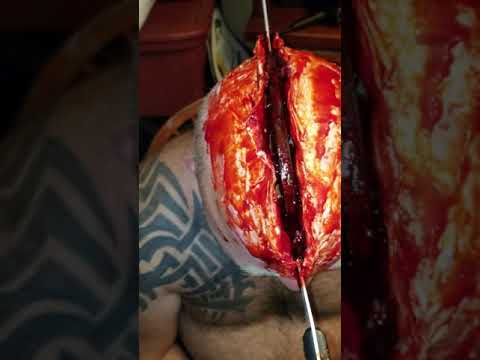 download lagu mp3 mp4 Head Split Open, download lagu Head Split Open gratis, unduh video klip Head Split Open