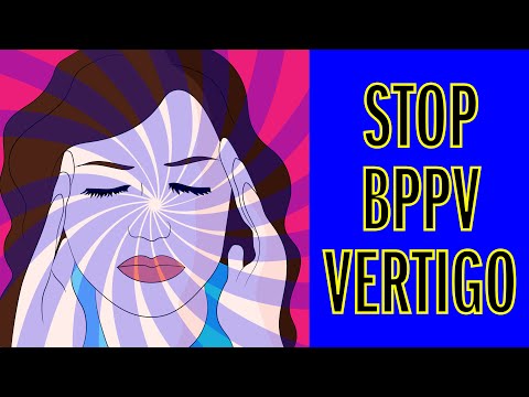 How to Fix BPPV Vertigo FAST!