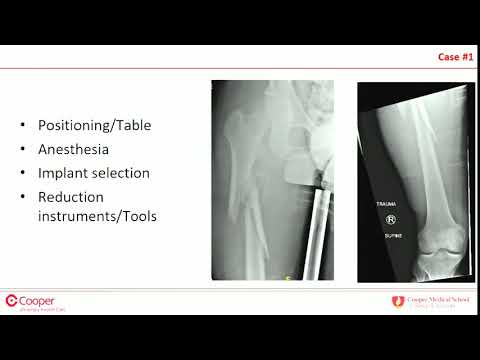 Artroza tratamentul articulațiilor genunchiului medicamente comprimate unguente