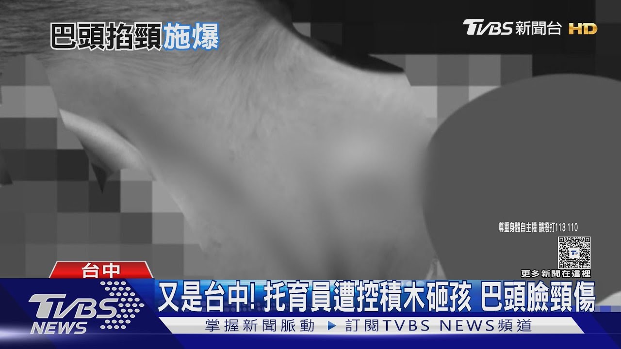 又是台中!托育員遭控積木砸孩 巴頭臉頸傷