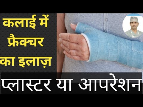 कलाई में फ्रैक्चर में प्लास्टर करवाये या ऑपरेशन / कौनसा इलाज बढ़िया रहेगा