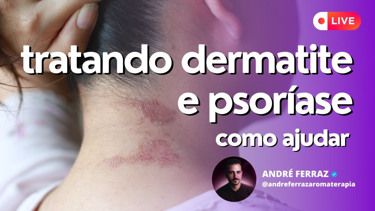 24/09 às 20h | Dermatite e Psoríase