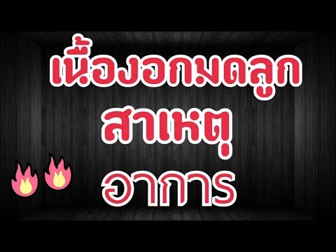 Neurodermatitis ยาเสพติด กลากที่ขาของเขาและภาพการรักษา