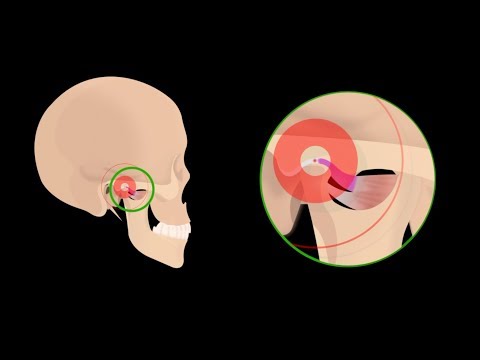 Ear Pain Due to TMJ (Jaw Joint) Disorders
