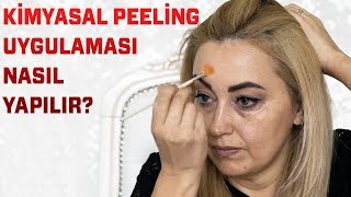 Kimyasal Peeling Uygulaması Nasıl Yapılır? Peeling Nedir?