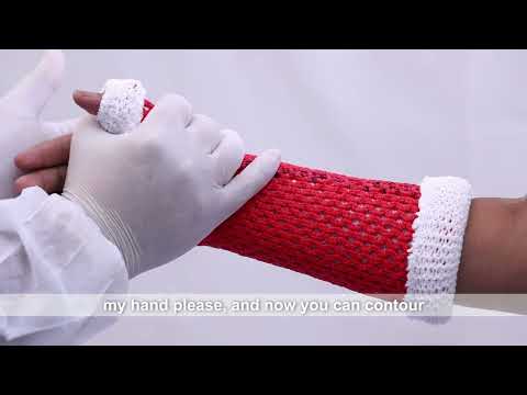 Below Elbow Cast