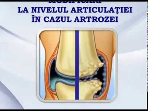 Erizipelele tratamentului articulațiilor