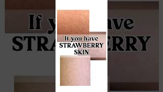 HOW TO EFFECTIVELY GET RID OF STRAWBERRY SKIN (Keratosis Pilaris)‼️