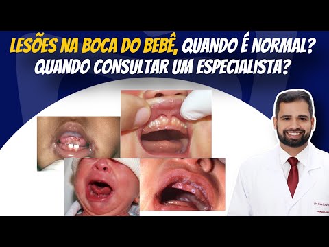 Francisco De Assis Almeida Lima Júnior-108