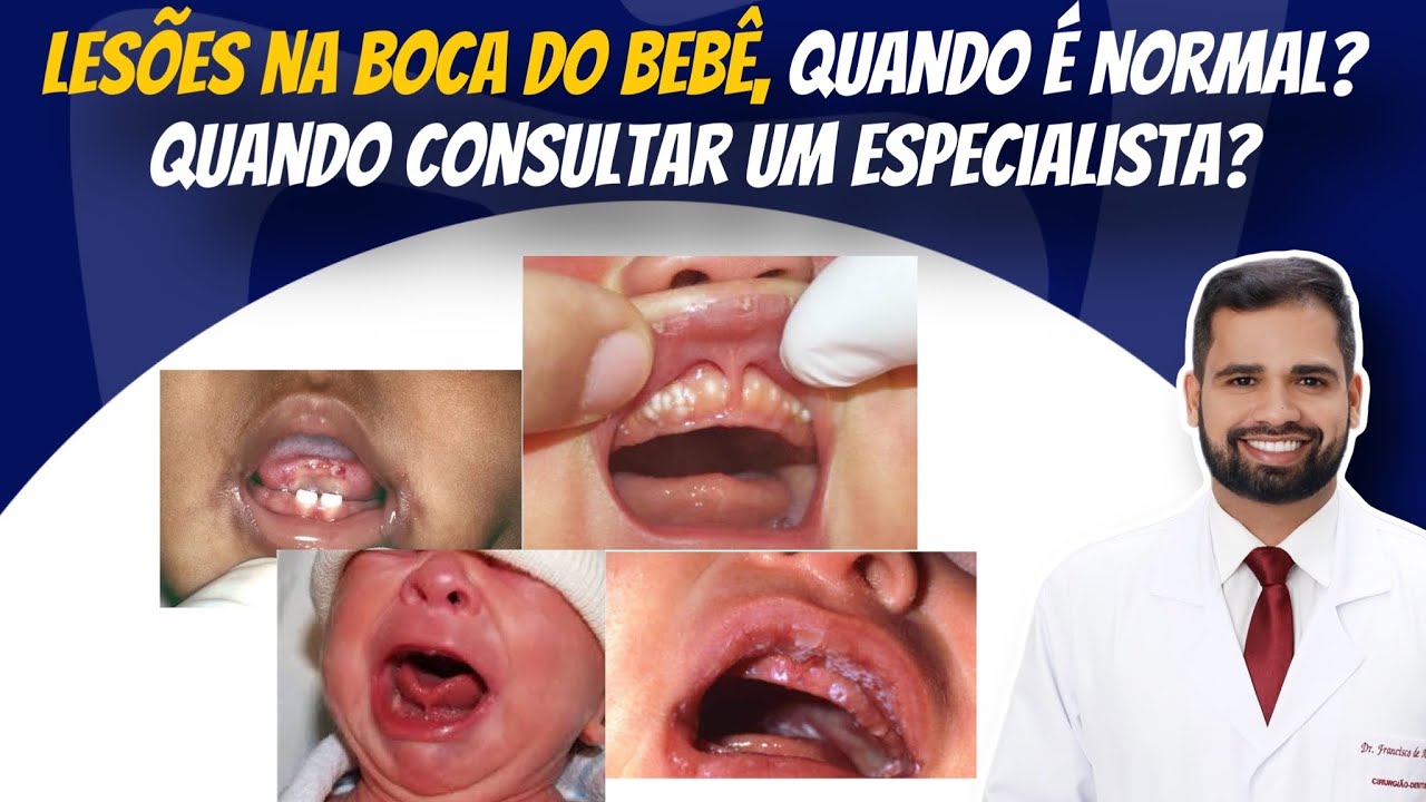 Francisco De Assis Almeida Lima Júnior-108