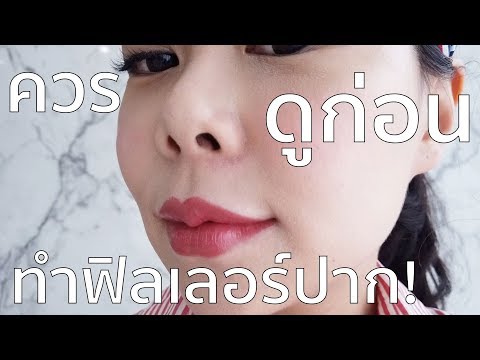 ฉีด ฟิลเลอร์ ปาก