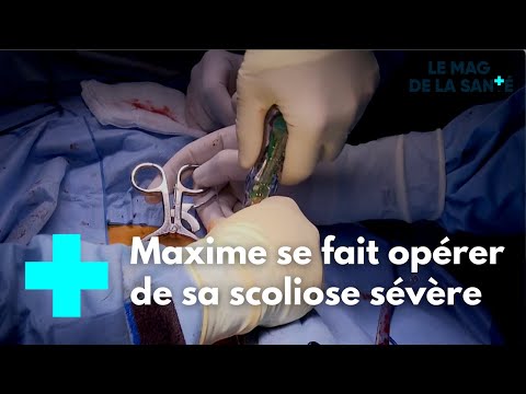 They repair children's skeletons 4/5 - The Health Magazine