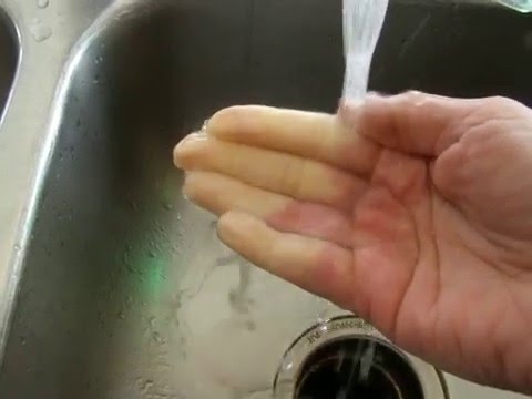 comment soigner syndrome raynaud